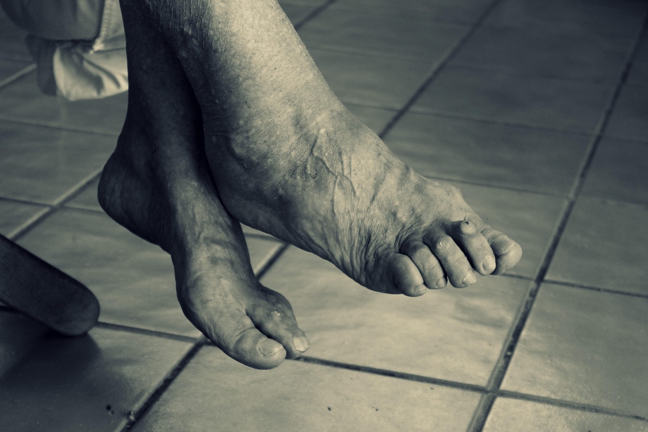 認知症介護におけるストレスを軽減する方法は？